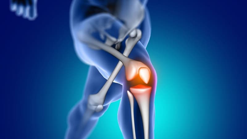 Bị thoái hóa khớp gối là gì?