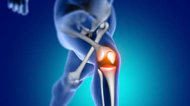 Những lưu ý quan trọng khi bị thoái hóa khớp gối