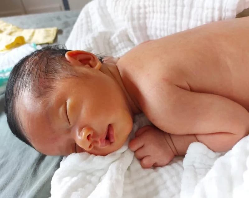 Mặc dù vàng da ở trẻ sơ sinh thường vô hại nhưng việc theo dõi và chăm sóc đúng cách là rất cần thiết.