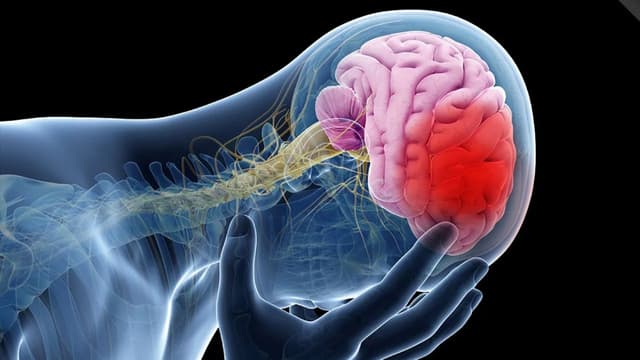 Các dạng đột quỵ não và cách nhận biết, điều trị