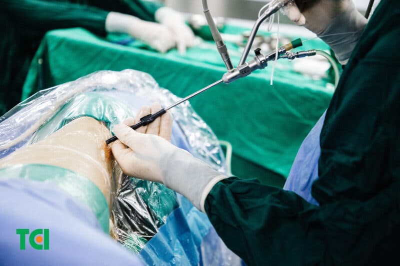 Tán sỏi tại Thu Cúc TCI