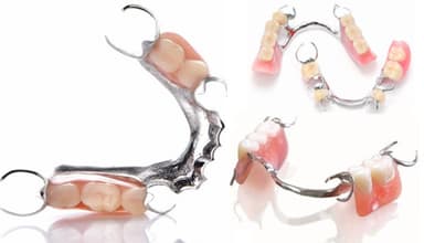 Phục hình răng giả tháo lắp có hiệu quả cho người mất răng?