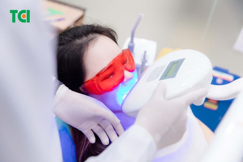 Tẩy trắng răng an toàn bằng chiếu tia laser