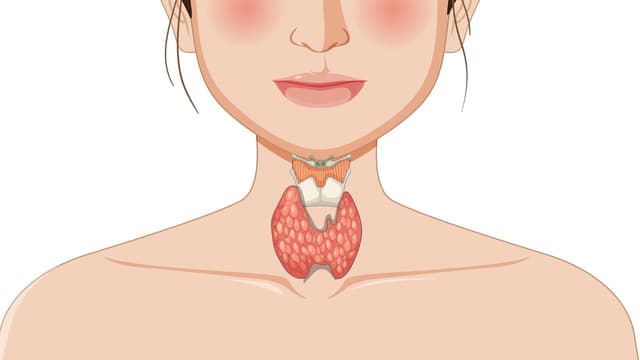 Nguyên nhân gây bệnh Basedow: Yếu tố khách quan và chủ quan