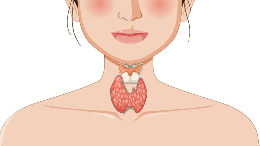 Nguyên nhân gây bệnh Basedow: Yếu tố khách quan và chủ quan