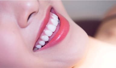 Những lưu ý trong cách chăm sóc răng bọc sứ bạn nên biết