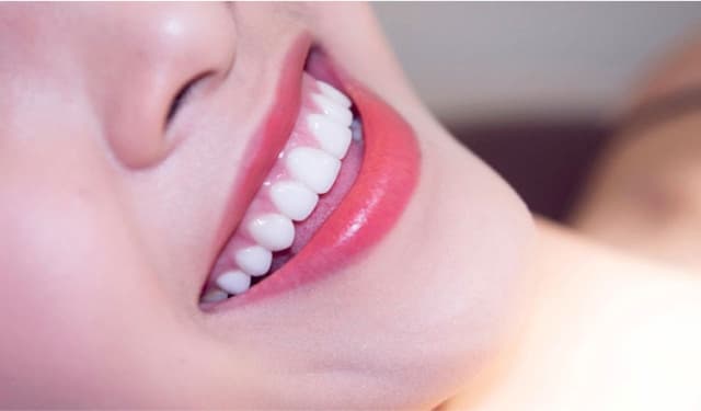 Những lưu ý trong cách chăm sóc răng bọc sứ bạn nên biết