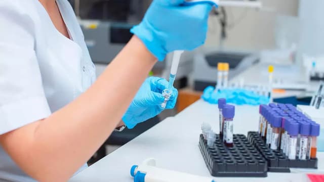 Giải đáp xét nghiệm gói khám sức khỏe tiền hôn nhân