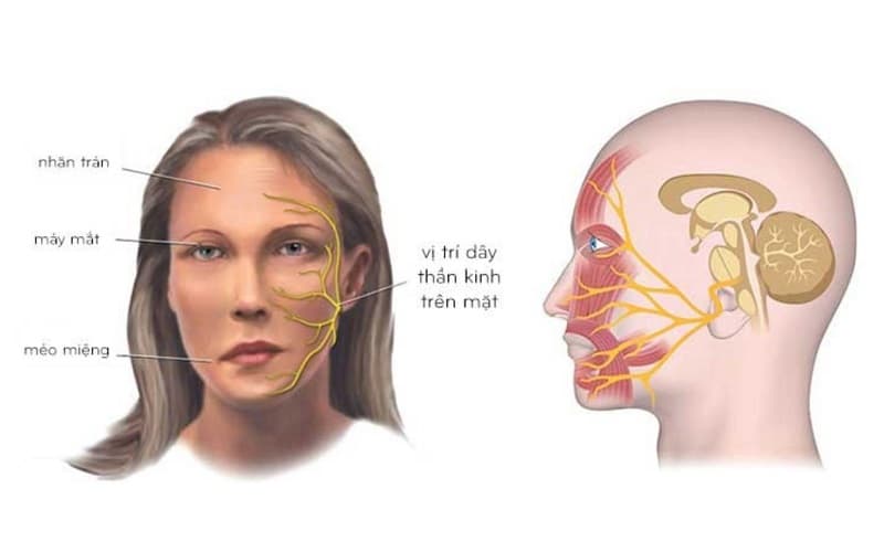 Khi dây thần kinh này bị tổn thương, người bệnh sẽ mất khả năng vận động tự nhiên của khuôn mặt.