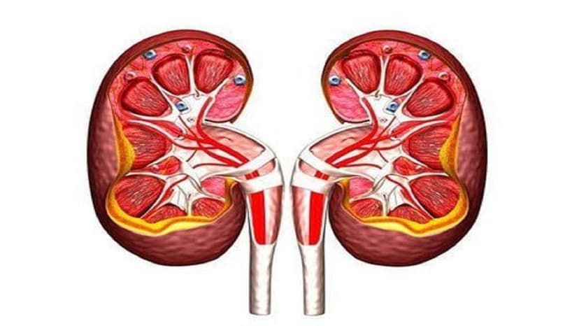 Thận ứ nước độ 2 là gì, nguyên nhân, triệu chứng và cách phòng 