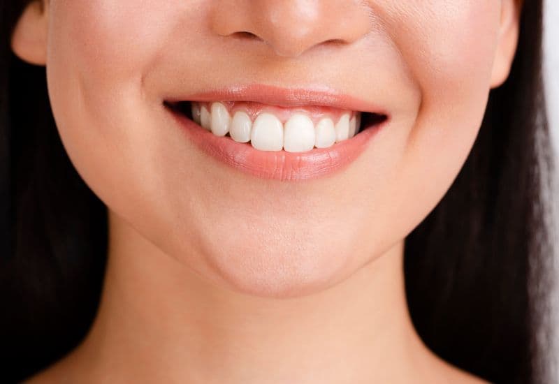 Giải đáp chi tiết thắc mắc: Có nên lấy cao răng không?