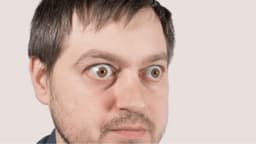 Mắt lồi nhẹ: Khi nào bạn cần thăm khám và can thiệp sớm