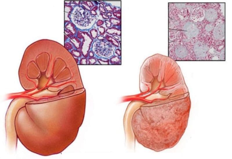 thuốc giảm đau kháng viêm