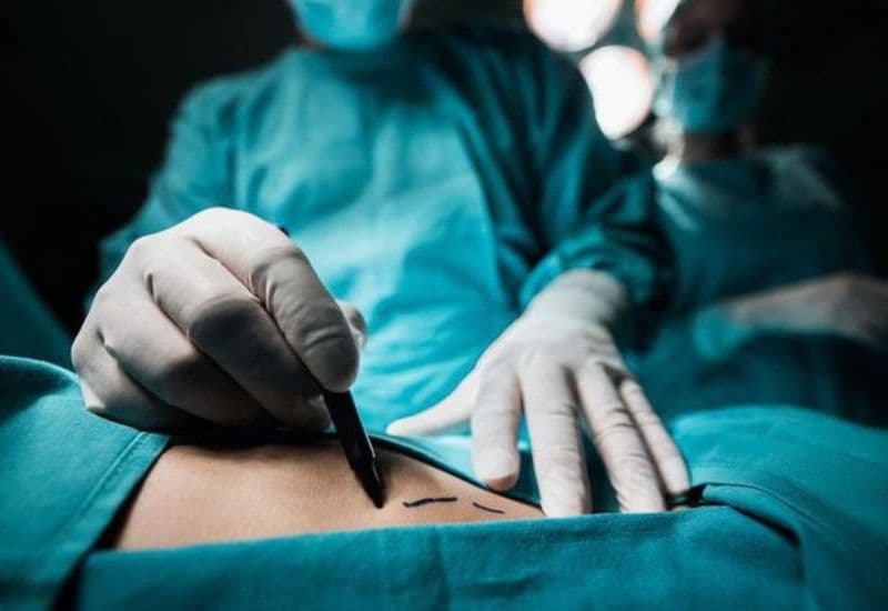 rò dưỡng chấp sau mổ tuyến giáp