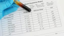 Chỉ số ALT cao trong xét nghiệm máu là gì?