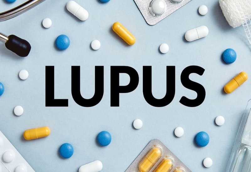 dấu hiệu bệnh Lupus ban đỏ giai đoạn đầu