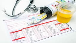 Chỉ số BIL trong xét nghiệm nước tiểu là gì?