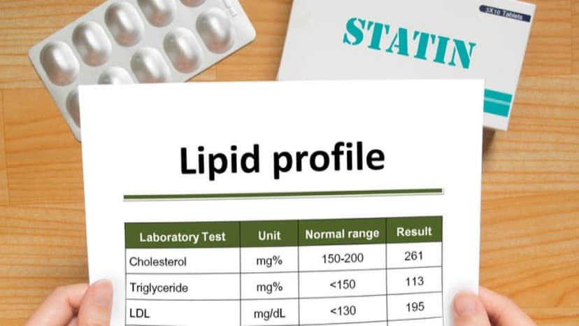 Các loại thuốc giảm mỡ máu phổ biến và lưu ý khi sử dụng