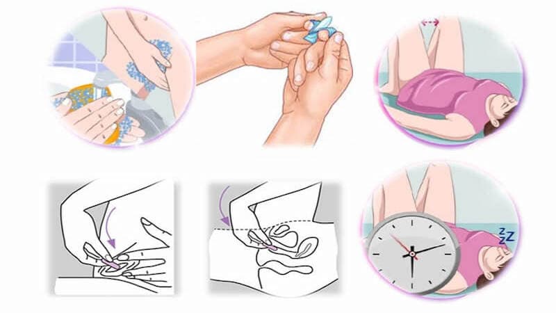 cách đặt thuốc phụ khoa