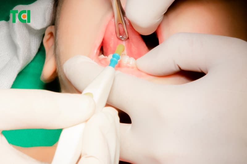 Phương pháp cắt thắng lưỡi gây mê giúp bé hồi phục nhanh chóng và được về nhà ngay trong ngày (Nguồn: TCI)