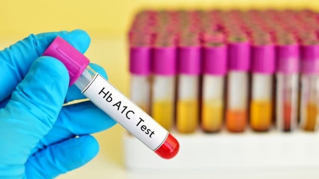 Chỉ số đường huyết 3 tháng bao nhiêu cần tiêm insulin?