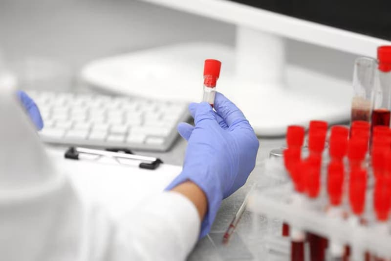 chỉ số ggt trong máu thấp