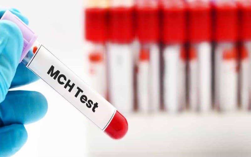 mchc thấp trong xét nghiệm máu là gì