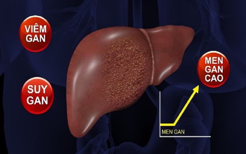 chỉ số men gan cao bao nhiêu là nguy hiểm