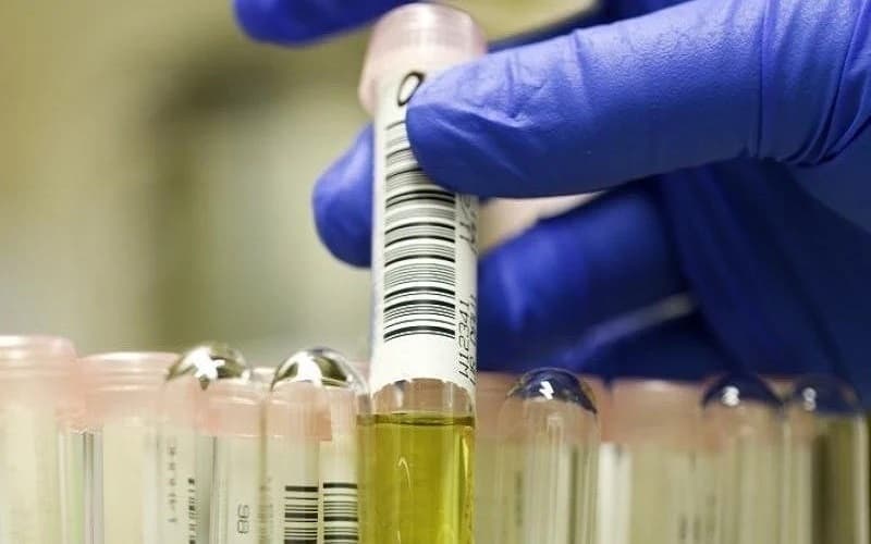 nit trong xét nghiệm nước tiểu