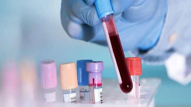 Chỉ số PCT trong máu cao là gì?