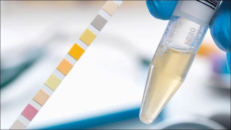 pH trong xét nghiệm nước tiểu là gì