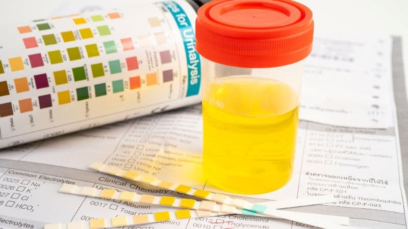 pH trong xét nghiệm nước tiểu là gì