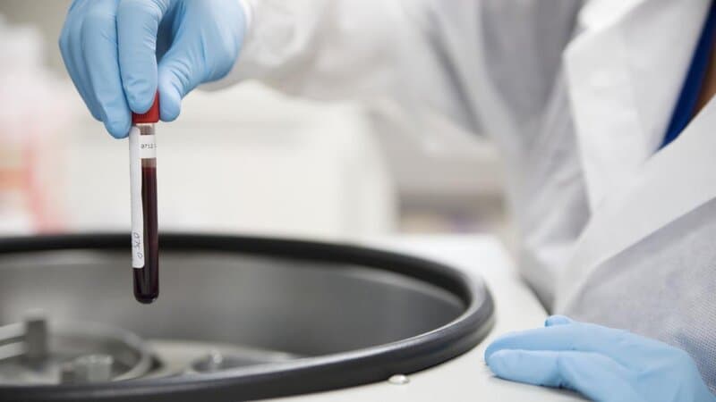 Chỉ số RDW trong máu thấp là gì