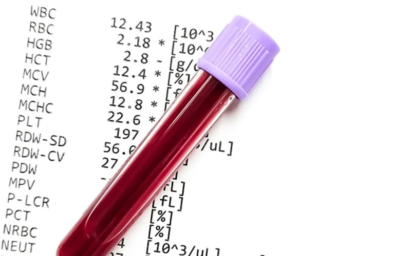 wbc thấp trong xét nghiệm máu là gì