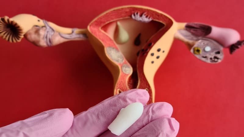 biểu hiện sau khi đặt thuốc phụ khoa thành công