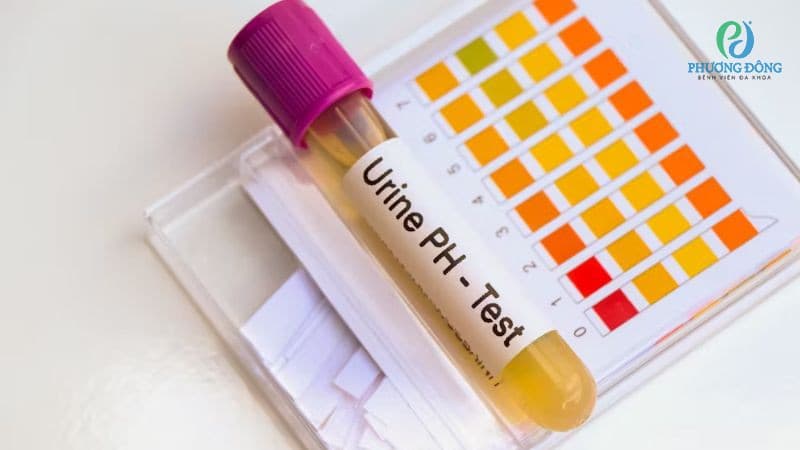 pH trong nước tiểu cao khi mang thai