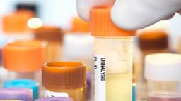 Chỉ số ERY trong xét nghiệm nước tiểu là gì?