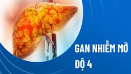 Bị gan nhiễm mỡ độ 4 sống được bao lâu?