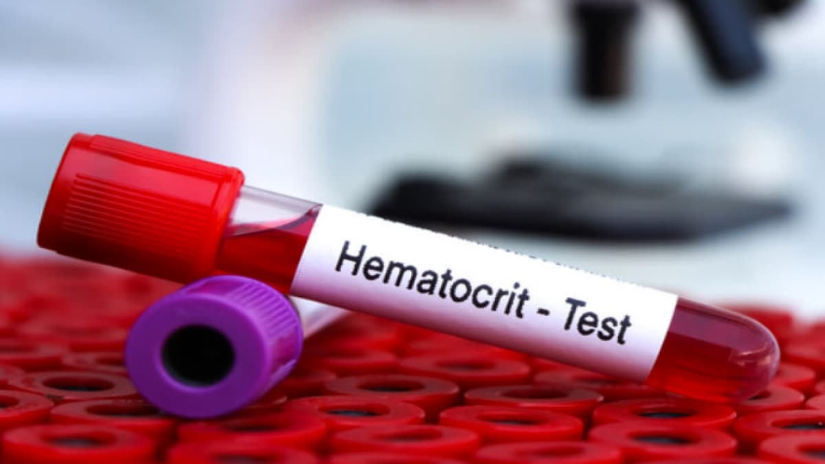 Chỉ số HCT cao trong xét nghiệm máu là bệnh gì?