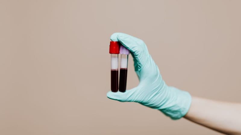 HCT trong xét nghiệm máu là gì