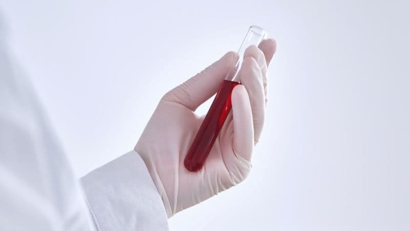 xét nghiệm HCT trong sốt xuất huyết