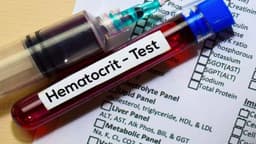 Chỉ số HCT thấp trong xét nghiệm máu là bệnh gì?