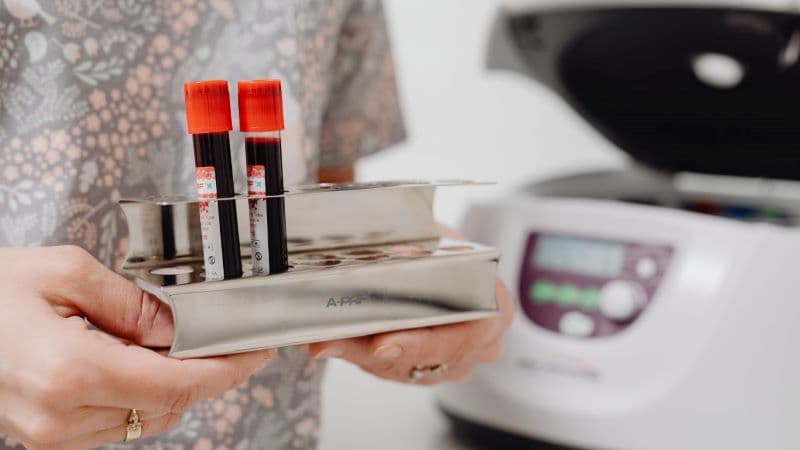 HCT trong xét nghiệm máu là gì