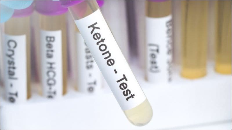 ket trong xét nghiệm nước tiểu là gì