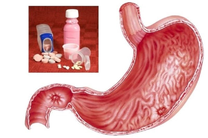 thuốc giảm tiết axit dạ dày omeprazol