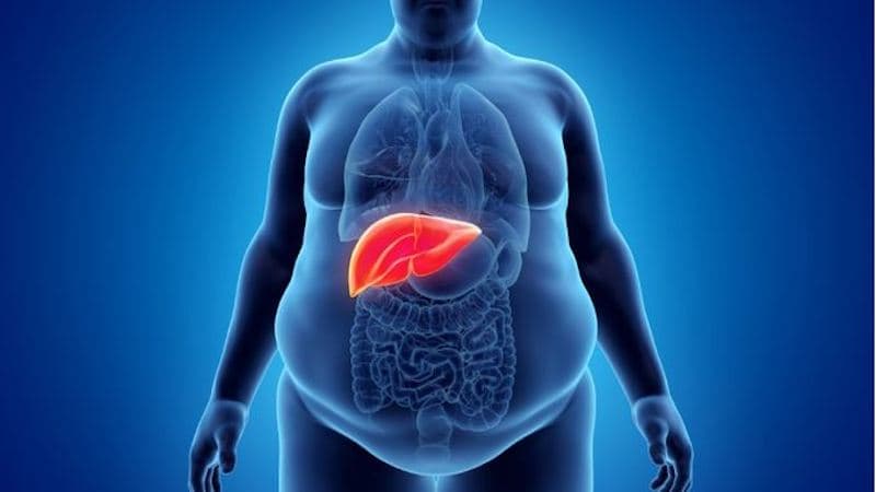 xét nghiệm gì để biết gan nhiễm mỡ