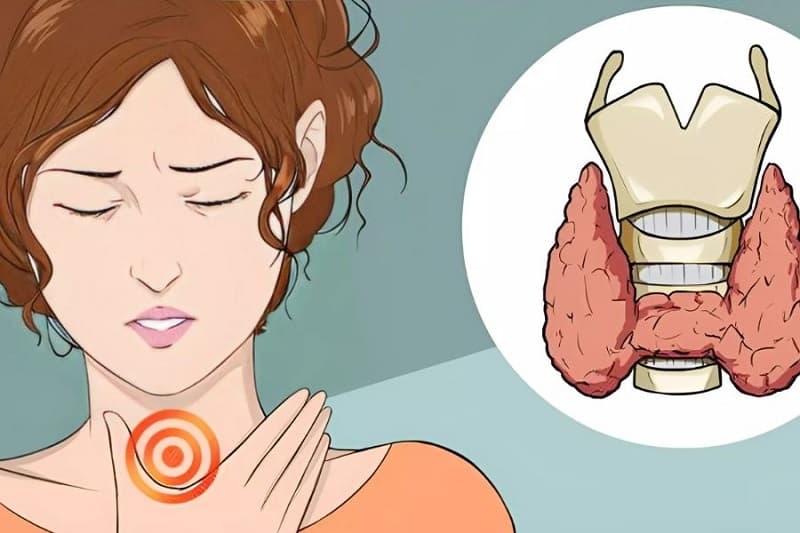 chữa khàn giọng sau mổ tuyến giáp