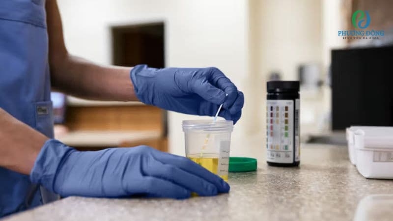 làm thế nào để giảm độ pH trong nước tiểu