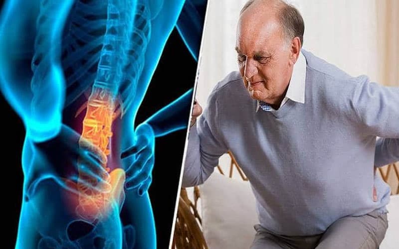 do bị thoát vị đĩa đệm