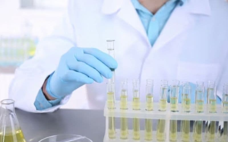 nước tiểu màu gì là tốt nhất